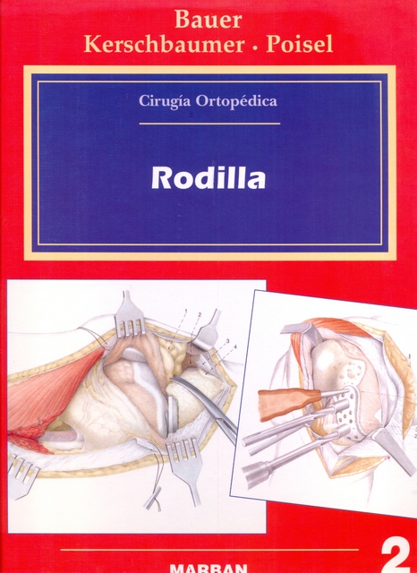 RODILLA