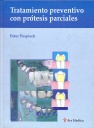 TRATAMIENTO PREVENTIVO CON PROTESIS PARCIALES