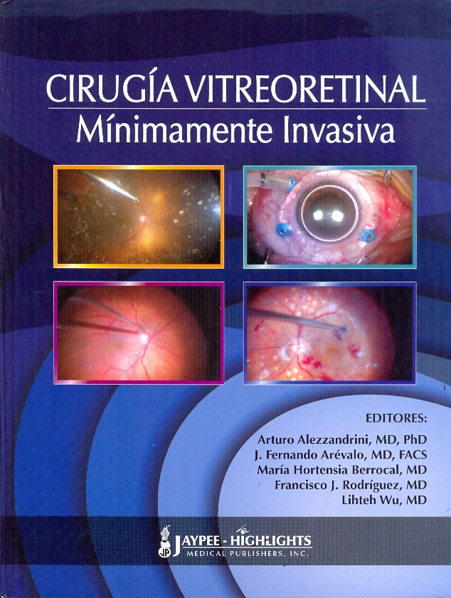 CIRUGÍA VITREORETINAL MÍNIMAMENTE INVASIVA