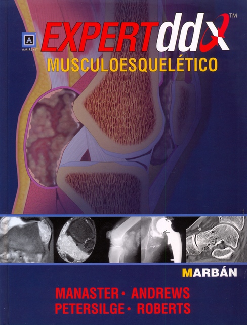 EXPERT DDX MUSCULOESQUELÉTICO - OFERTA