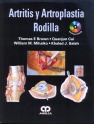 ARTRITIS Y ARTROPLASTIA RODILLA