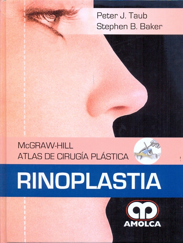 RINOPLASTIA. ATLAS DE CIRUGÍA PLÁSTICA