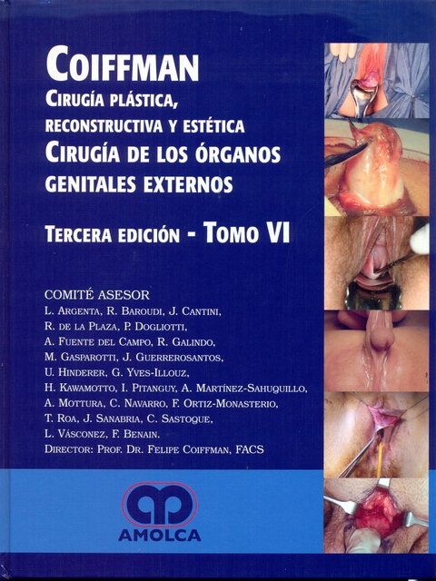 CIRUGÍA PLÁSTICA, RECONSTRUCTIVA y ESTÉTICA. Cirugía de los órganos genitales externos
