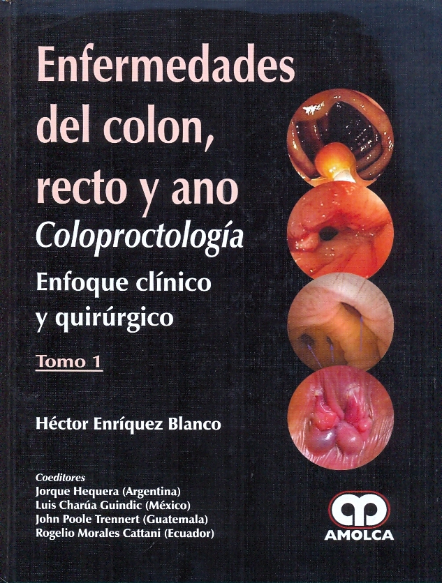 Enfermedades del Colon - Recto - Ano. Coloproctologia Enfoque Clinico y Quirurgico