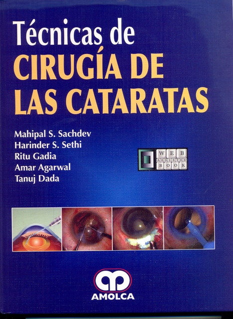 TECNICAS DE CIRUGIA DE LAS CATARATAS
