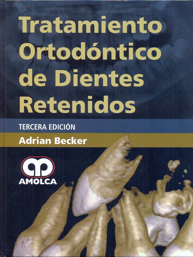 TRATAMIENTO ORTODÓNTICO DE DIENTES RETENIDOS