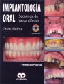 IMPLANTOLOGIA ORAL. SECUENCIA DE CARGA DIFERIDA