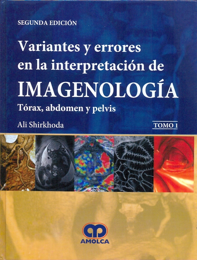 VARIANTES Y ERRORES EN LA INTERPRETACION DE LA IMAGENOLOGIA TORAX ABDOMEN Y PELVIS