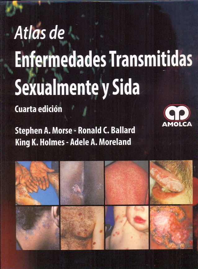 ATLAS DE ENFERMEDADES TRANSMITIDAS SEXUALMENTE Y SIDA