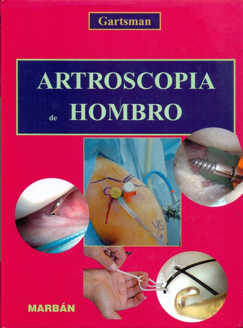 ARTROSCOPIA DE HOMBRO