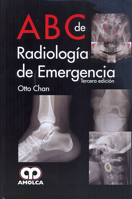 ABC DE RADIOLOGÍA DE EMERGENCIA
