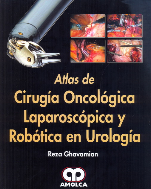 Atlas de Cirugía Oncológica Laparoscópica