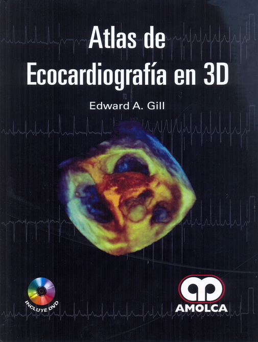 Atlas de Ecocardiografía en 3D