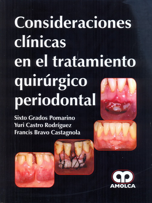 Consideraciones Clínicas en el Tratamiento Quirúrgico Periodontal