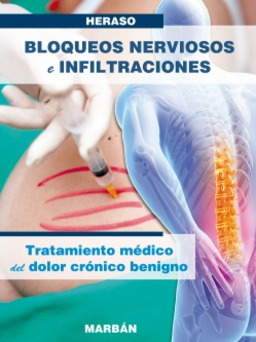 BLOQUEOS NERVIOSOS E INFILTRACIONES. TRATAMIENTO MEDICO DEL DOLOR CRONICO BENIGNO. MANUAL