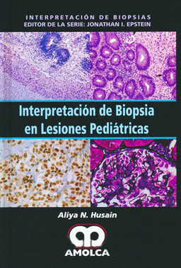 INTERPRETACION DE BIOPSIA EN LESIONES PEDIATRICAS (INTERPRETACION DE BIOPSIAS)
