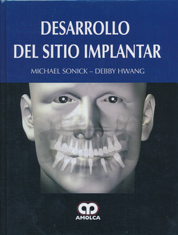 DESARROLLO DEL SITIO IMPLANTAR