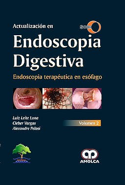 Actualización en Endoscopia Digestiva, Vol. 2: Endoscopia Terapéutica en Esófago. SOBED