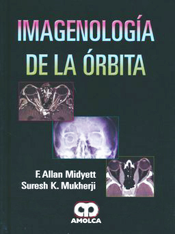 IMAGENOLOGIA DE LA ORBITA