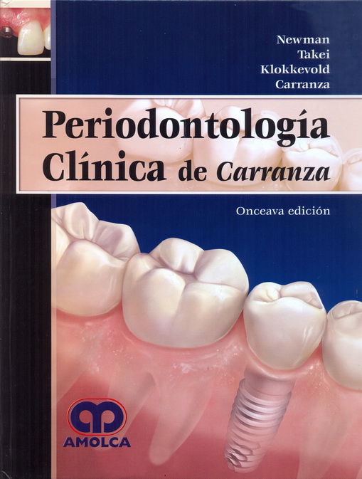 Periodontología Clínica de Carranza