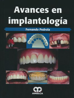 AVANCES EN IMPLANTOLOGIA