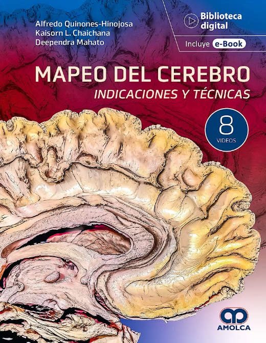 Mapeo del Cerebro. Indicaciones y Técnicas