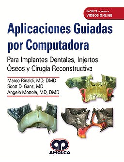 Aplicaciones Guiadas por Computadora. Para Implantes Dentales, Injertos Óseos y Cirugía Reconstructiva + Videos Online