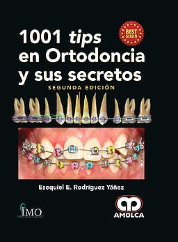 1001 Tips en Ortodoncia y Sus Secretos
