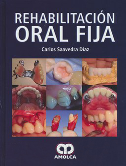 REHABILITACION ORAL FIJA