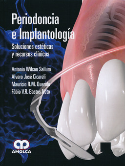 PERIODONCIA E IMPLANTOLOGIA SOLUCIONES ESTETICAS