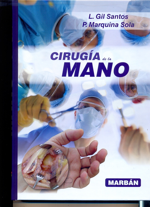CIRUGÍA DE LA MANO