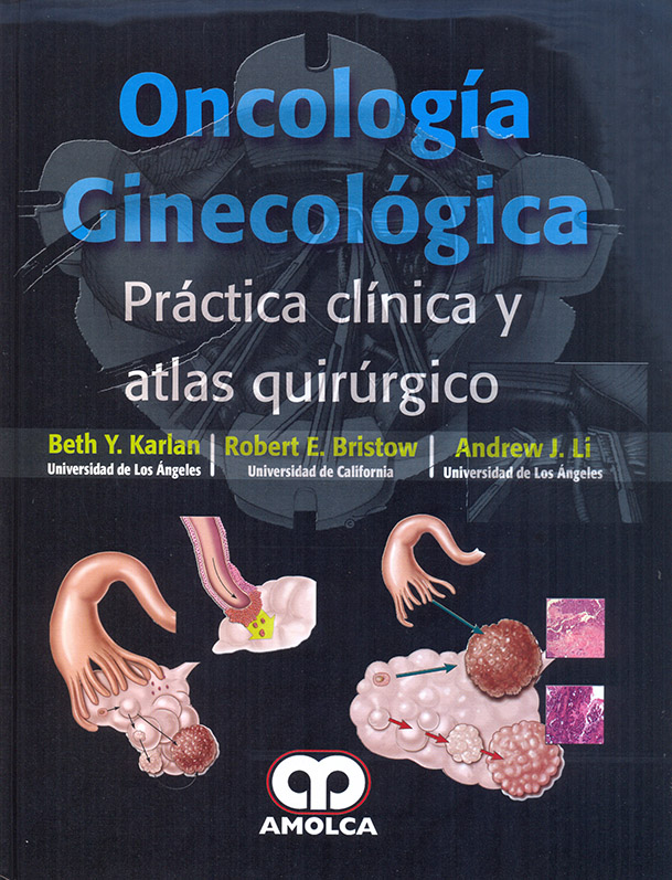 Oncología Ginecológica – Práctica clínica y atlas quirúrgico
