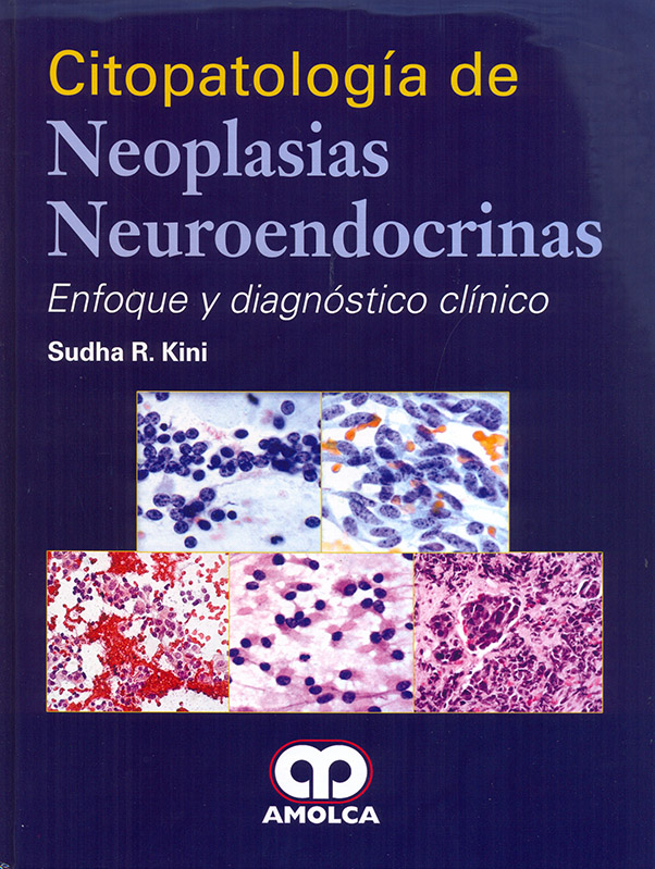 Citopatología de Neoplasias Neuroendocrinas – Enfoque y Diagnóstico Clínico