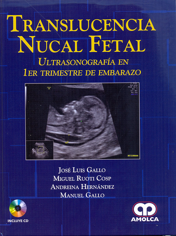 Translucencia Nucal Fetal – Ultrasonografía en 1er trimestre de embarazo
