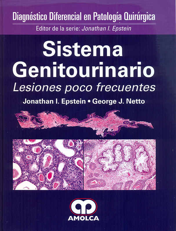 Diagnóstico Diferencial en Patología Quirúrgica: SISTEMA GENITOURINARIO – Lesiones poco frecuentes