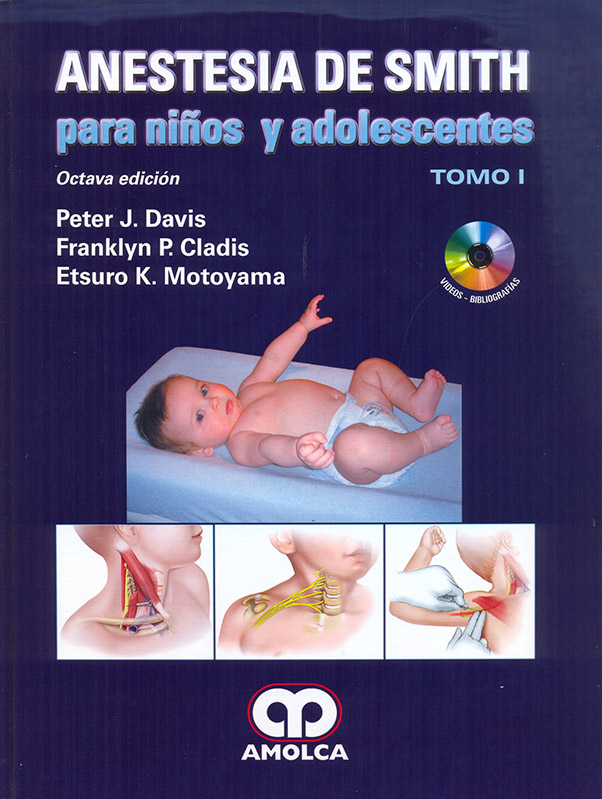 Anestesia de Smith para Niños y Adolescentes