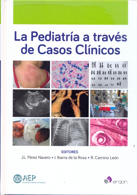 LA PEDIATRÍA A TRAVÉS DE CASOS CLÍNICOS