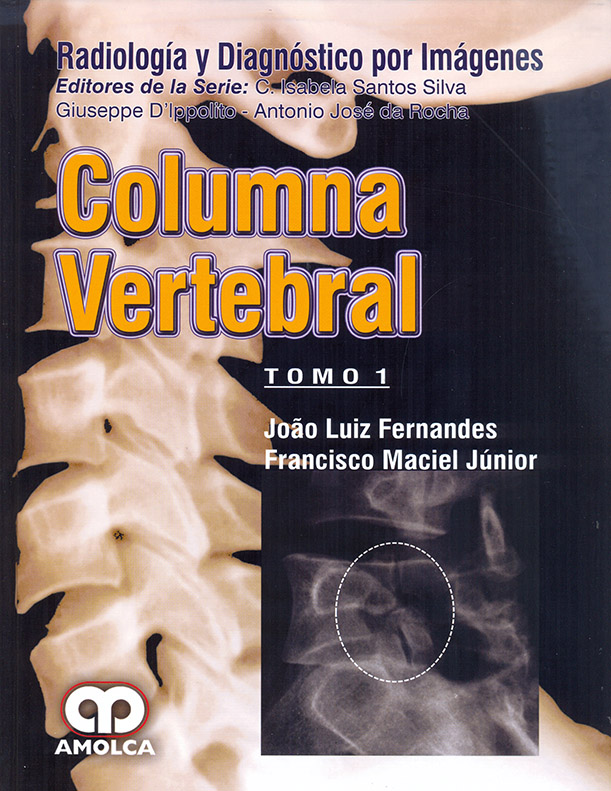 Radiología y Diagnóstico por Imagenes - Columna Vertebral