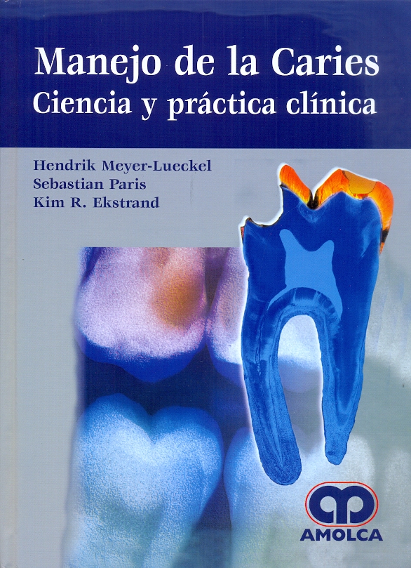 MANEJO DE LA CARIES.