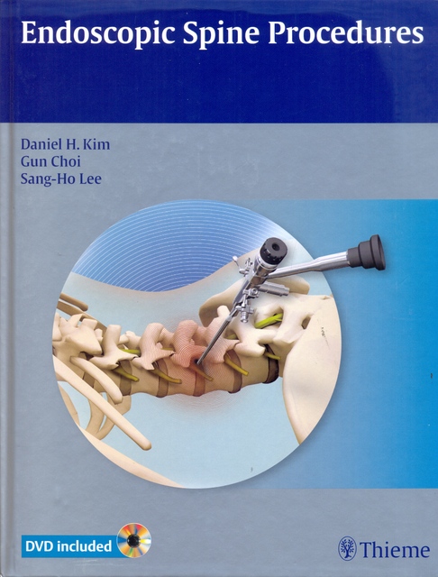 ENDOSCOPIC SPINE PROCEDURES