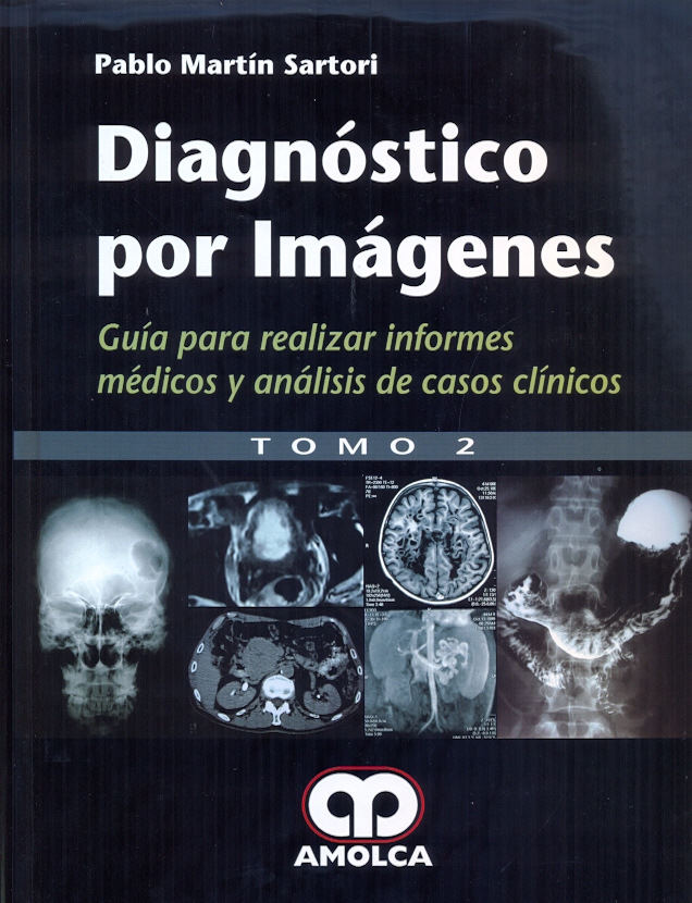 DIAGNÓSTICO POR IMÁGENES. GUIA PARA REALIZAR INFORMES MÉDICOS Y ANÁLISIS DE CASOS. 2 Tomos
