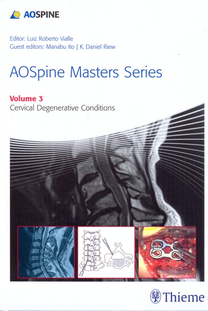 AOSPINE MASTERS SERIES. Cervical Degenerative Conditions. Volumen 3