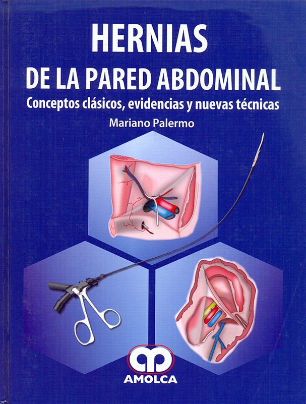 HERNIAS DE LA PARED ABDOMINAL