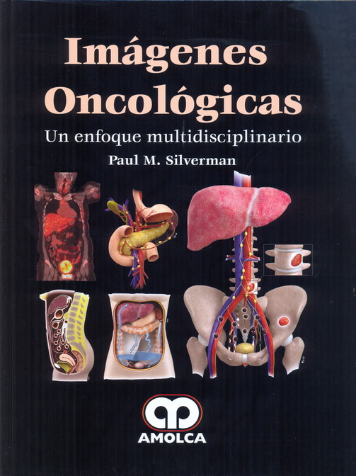 Imágenes Oncológicas
Un Enfoque Multidisciplinario