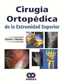 Cirugía Ortopédica de la Extremidad Superior