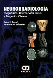 NEURORRADIOLOGIA. DIAGNOSTICOS DIFERENCIALES CLAVES Y PREGUNTAS CLINICAS