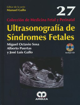 ULTRASONOGRAFIA DE SINDROMES FETALES (COLECCION DE MEDICINA FETAL Y PERINATAL, VOL. 27)