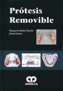 PROTESIS REMOVIBLE