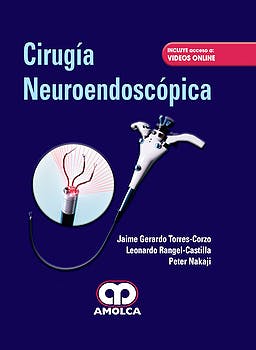 Cirugía Neuroendoscópica + Videos Online