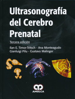 ULTRASONOGRAFIA DEL CEREBRO PRENATAL